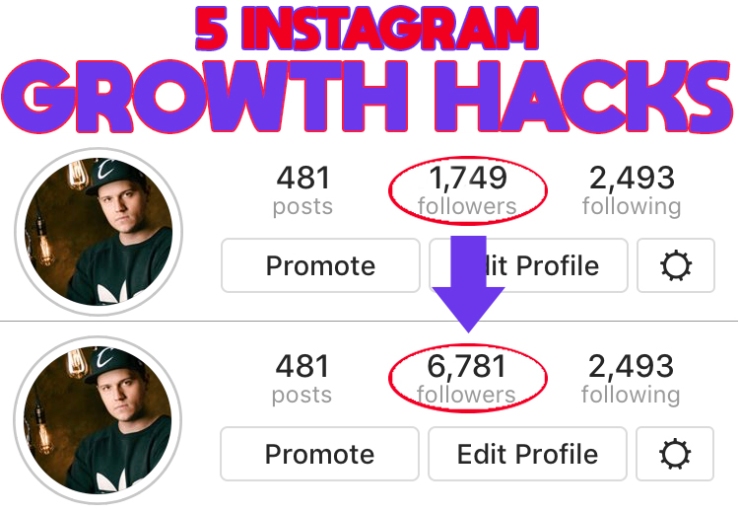 5 Instagram Growth Hacks